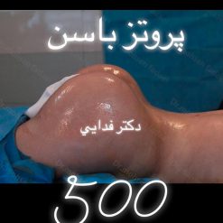 زرع جسم اصطناعي في الأرداف في ايران - دکتورمحسن فدائی