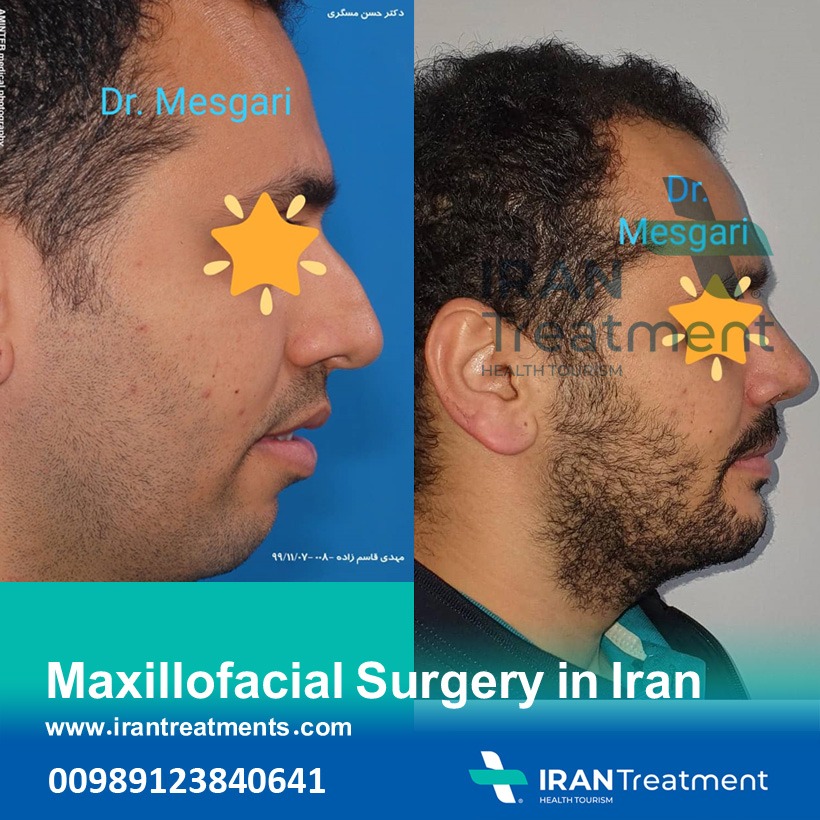 جراح الفم والوجه والفكين في إيران