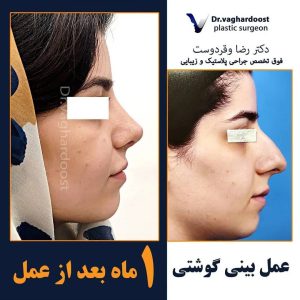 أفضل جراح الأنف في إيران