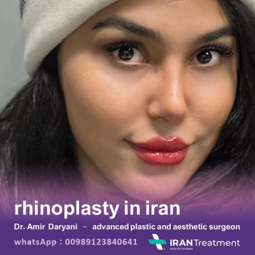 جراحة تجميل الأنف في ايران - الدكتور أمير درياني