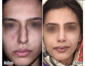 دكتور. شاهين باستاني نجاد - أخصائي أنف وأذن وحنجرة في إيران