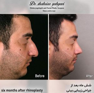 دكتور. شهريار يحيوي - أخصائي أنف وأذن وحنجرة في إيران