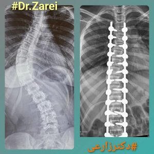 دكتور محمد زارعي - أخصائي علاج العظام وجراحة العمود الفقري