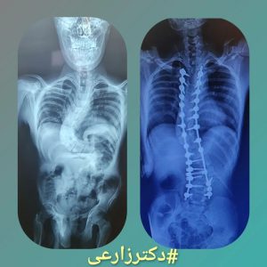 دكتور محمد زارعي - أخصائي علاج العظام وجراحة العمود الفقري