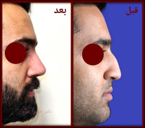 الدكتور هادي خرم - جراح الأنف في إيران