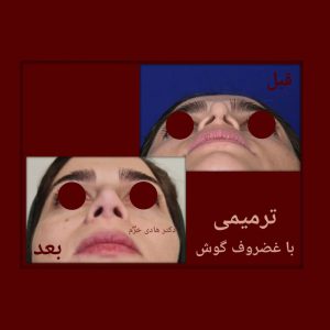 الدكتور هادي خرم - جراح الأنف في إيران
